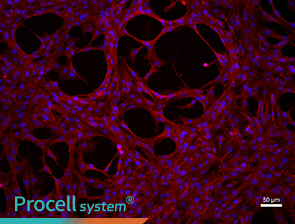Immunofluorescence assay (CD31)