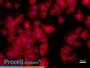 Immunofluorescence assay (CK-18)