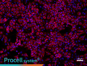 Immunofluorescence assay (Collagen I)