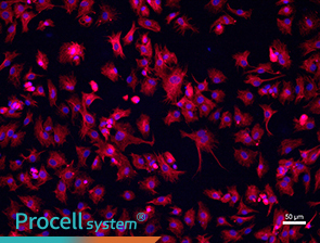 Immunofluorescence assay (Vimentin)