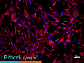 Immunofluorescence assay (Vimentin)