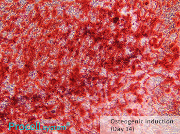 Alizarin Red Staining, 100×