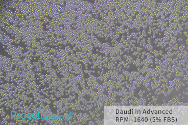 Growth comparison of multiple cell lines cultured in Procell® Advanced RPMI-1640