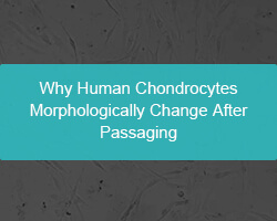 Why Human Chondrocytes Morphologically Change After Passaging? - cover