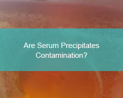Are Serum Precipitates Contamination? - cover