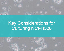 Key Considerations for Culturing NCI-H520 - cover