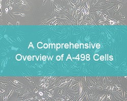A Comprehensive Overview of A-498 Cells
