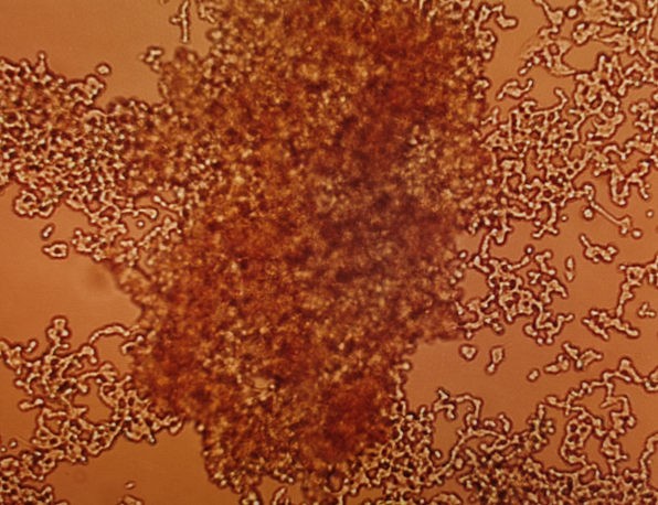 How to Successfully Culture SH-SY5Y Cells: Key Details to Consider-1