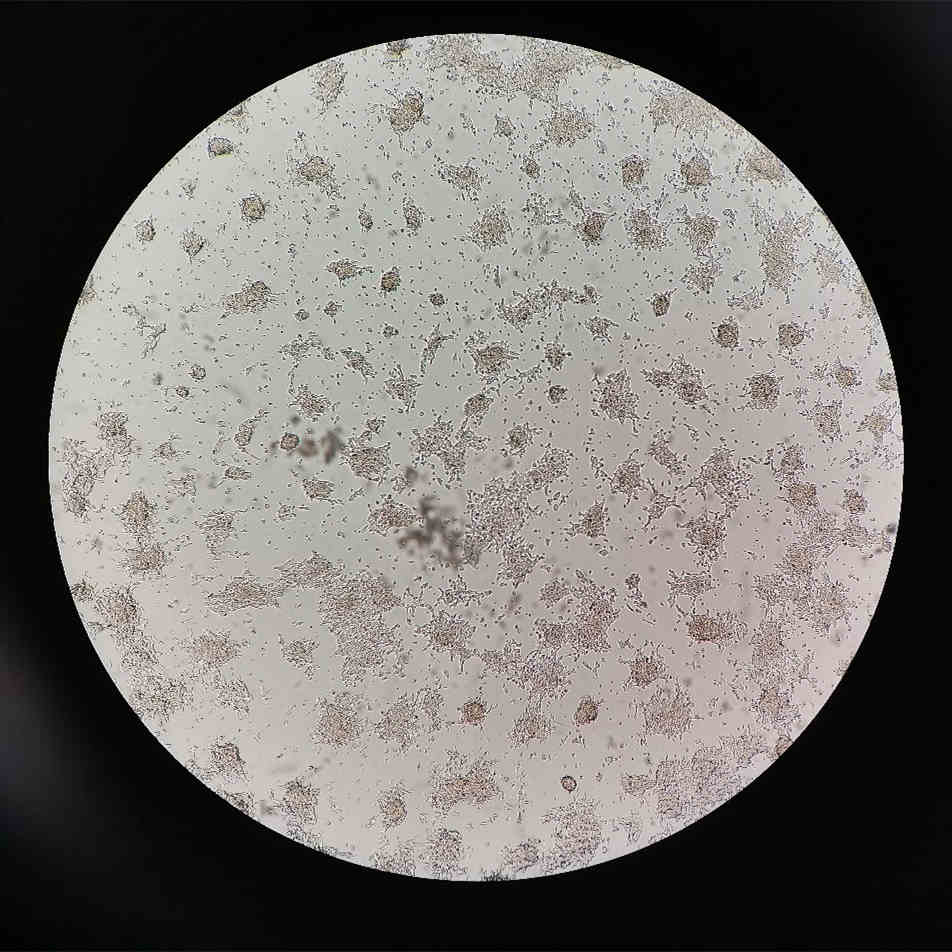 How to Successfully Culture SH-SY5Y Cells: Key Details to Consider-4