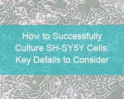How to Successfully Culture SH-SY5Y Cells: Key Details to Consider - cover