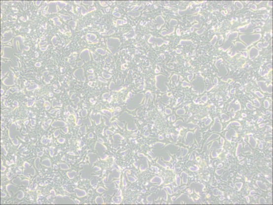 LNCaP Clone FGC Cell Culture: A Comprehensive Guide-1