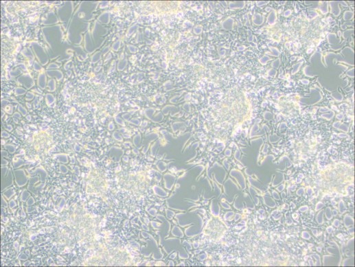 LNCaP Clone FGC Cell Culture: A Comprehensive Guide-2