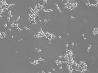 LNCaP Clone FGC Cell Culture: A Comprehensive Guide-4