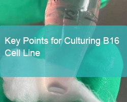 Key Points for Culturing B16 Cell Line