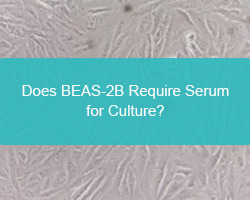 Does BEAS-2B Require Serum for Culture? - cover