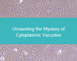 Unraveling the Mystery of Cytoplasmic Vacuoles - cover