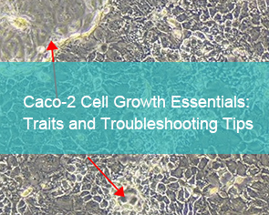 Caco-2 Cell Growth Essentials: Traits and Troubleshooting Tips - cover