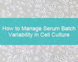 How to Manage Serum Batch Variability in Cell Culture - cover