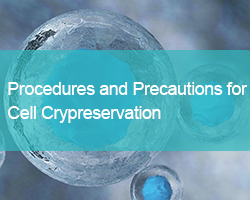 Procedures and Precautions for Cryopreservation of Adherent Cells and Suspension Cells - cover