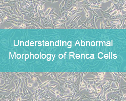 Understanding Abnormal Morphology of Renca Cells - cover